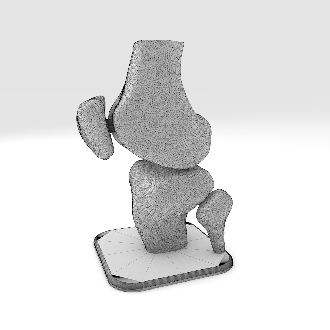 Modello con stampa 3d al ginocchio MRI-DICOM