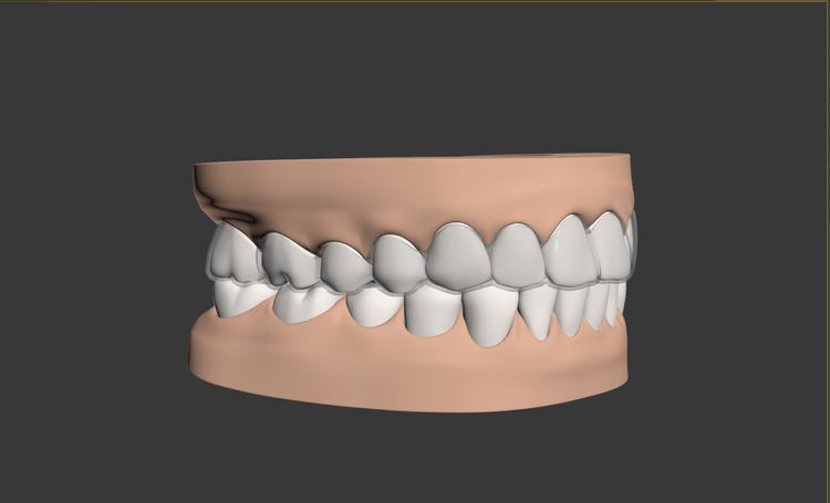 Szimuláció fogsor felnőtt fogak 3d modell 3D modell