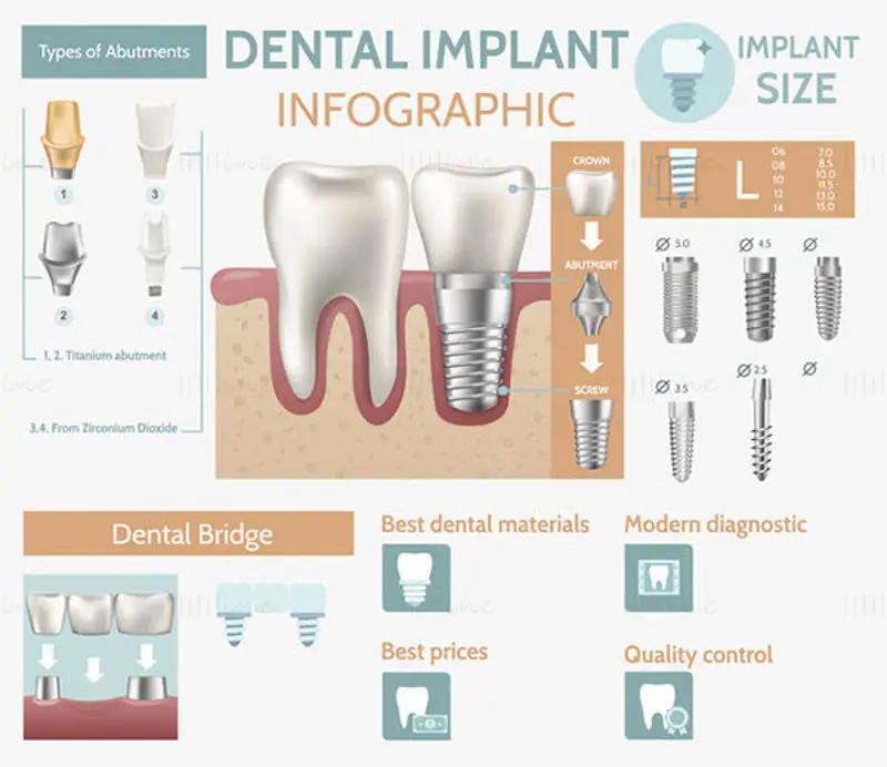 Dental infographic vector