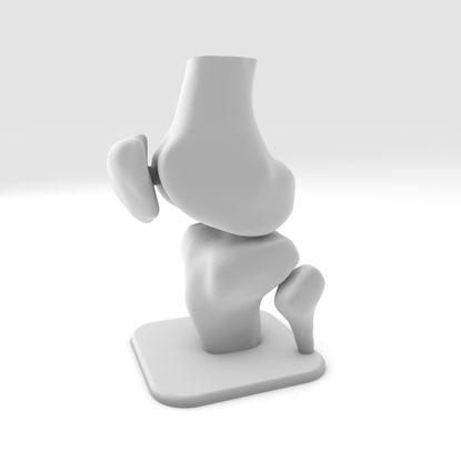 MRI-DICOM 3D-model voor knie