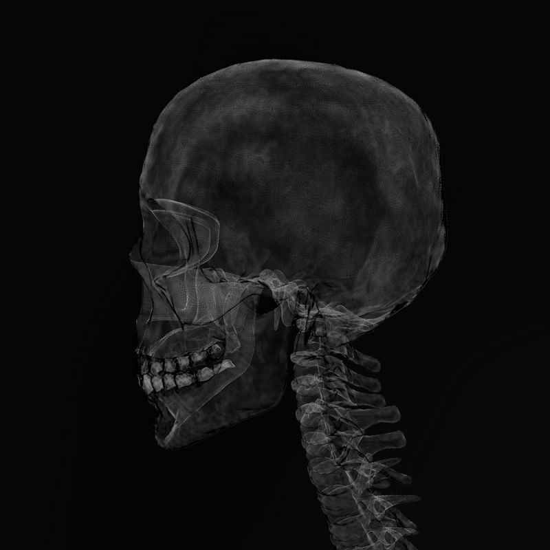 X Ray CT effect 3D Material
