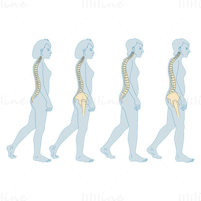 Illustrazione scientifica del vettore osseo dell'osteoporosi della premenopausa dell'adulto