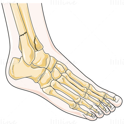 Ankle fractures vector