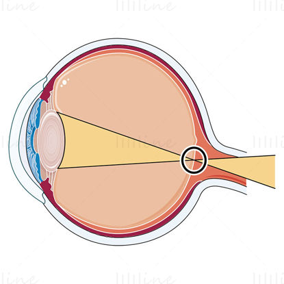 Astigmatisk øye vektor illustrasjon