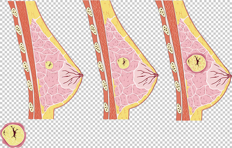 Breast cancer vector scientific illustration