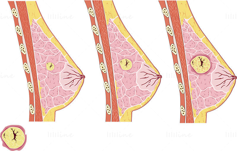 Breast cancer vector scientific illustration