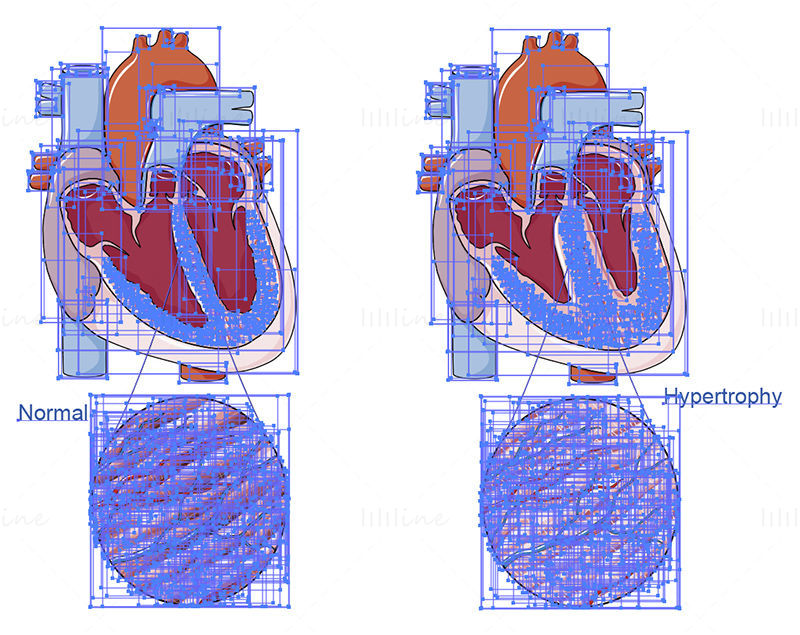 Cardiac hypertrophy vector