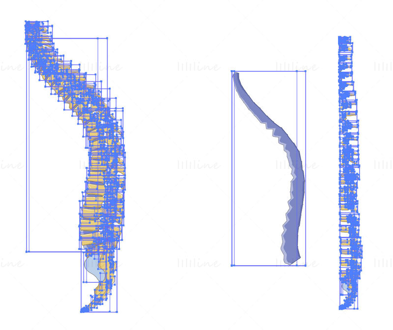 Compression of the vertebrae vector scientific illustration