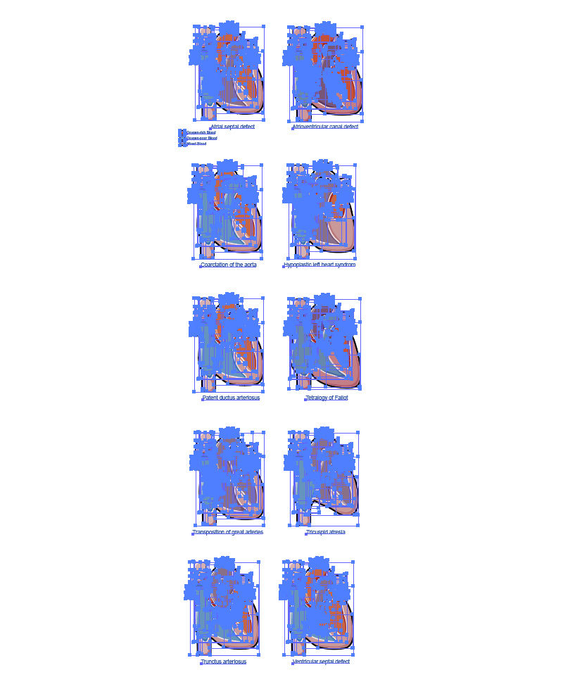 Congenital heart diseases vector