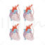 Coronary Artery Bypass Grafting vector