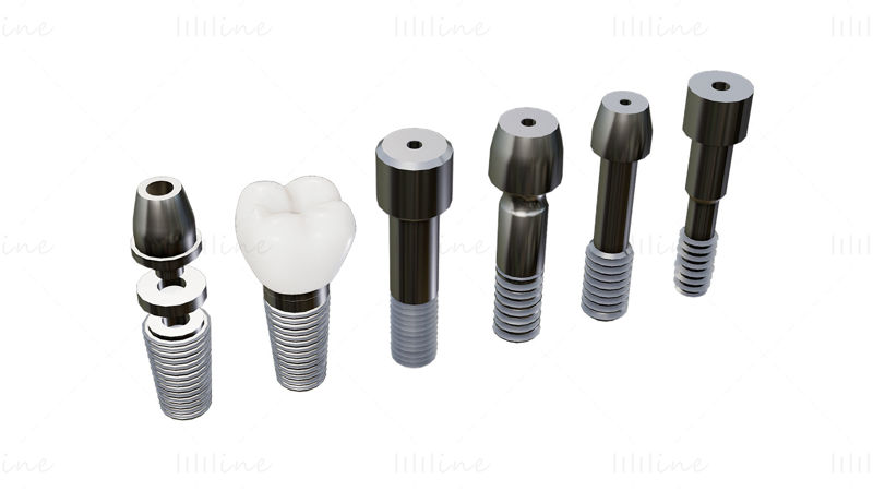 Пакет 3D-моделей зубного имплантата — 6 в 1