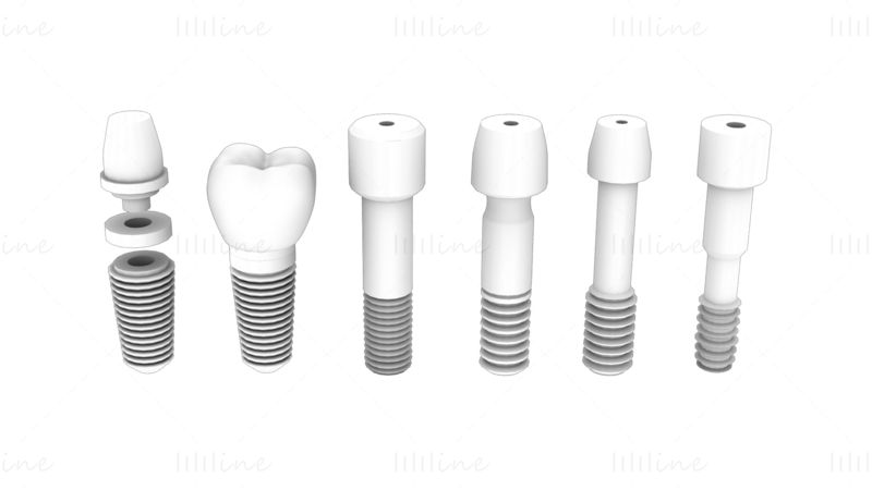 Пакет 3D-моделей зубного имплантата — 6 в 1