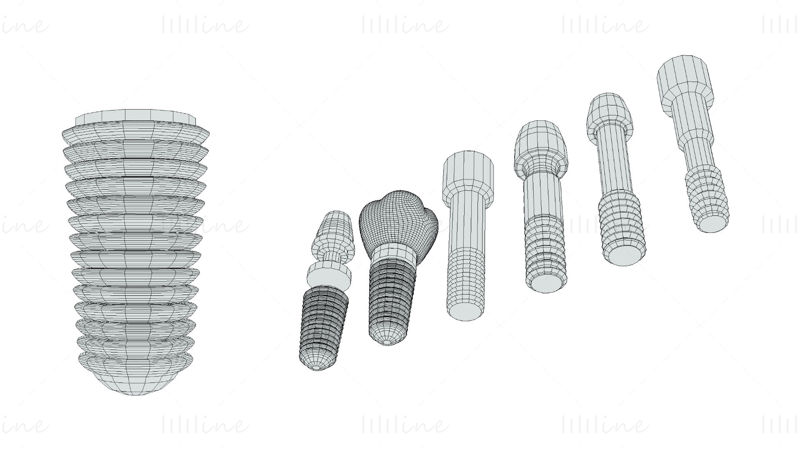 Pack de modèles 3D d'implants dentaires - 6 en 1
