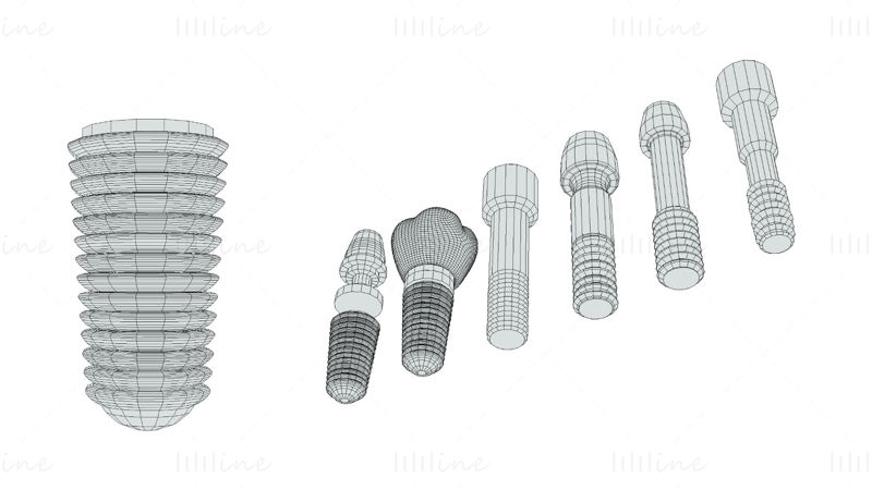 Tandheelkundig implantaat 3D-modelpakket - 6 in 1