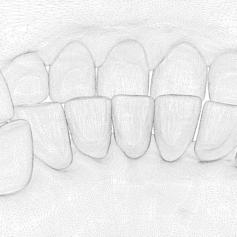 3D model formy na zubní protézy