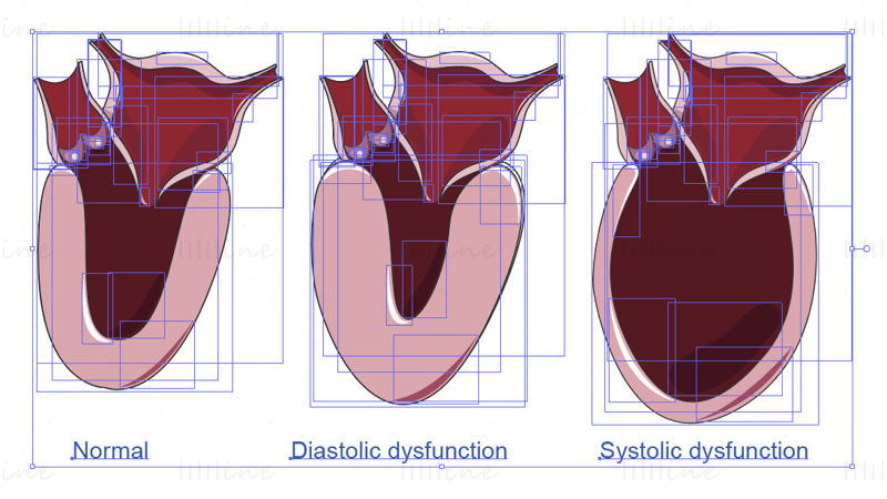 Diastolic and systolic dysfunctions vector