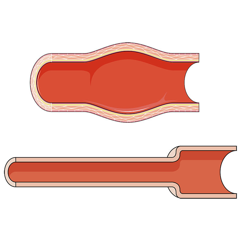 dilated-artery-vector-illustration