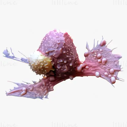 3D-Modell des Krebszelltumors herunterladen