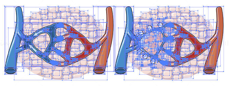 Edema formation vector illustration