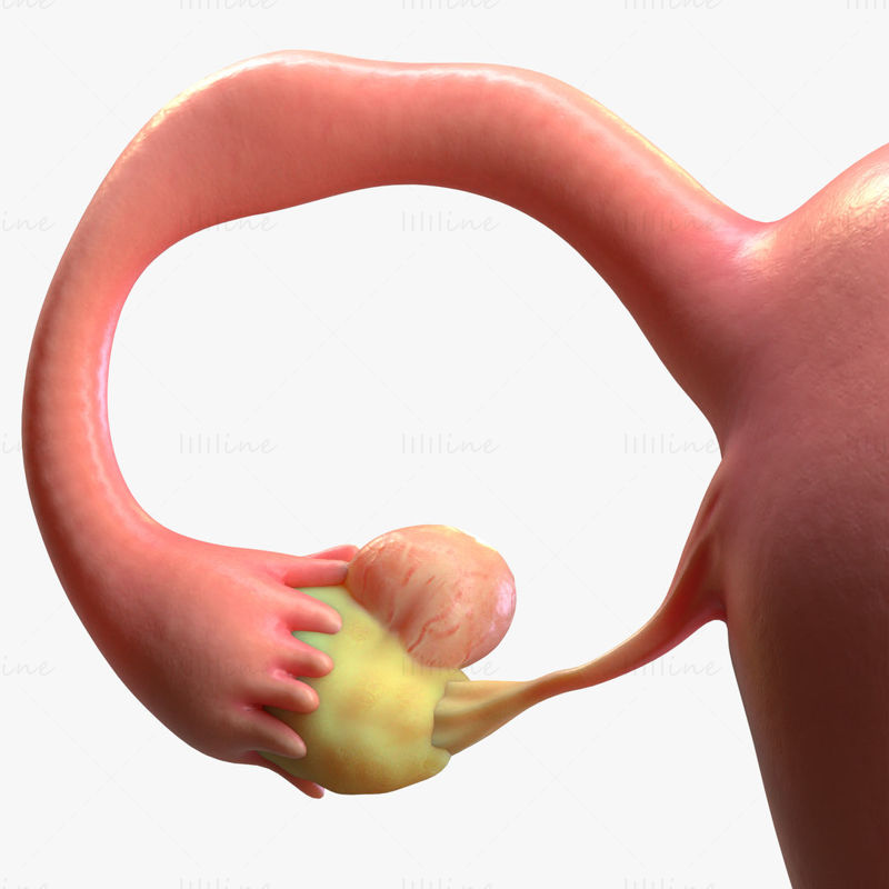 Female Reproductive System Cyst 3D Model