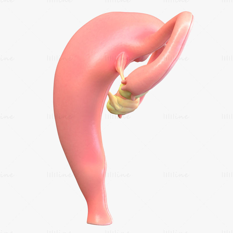 Female Reproductive System Cyst 3D Model