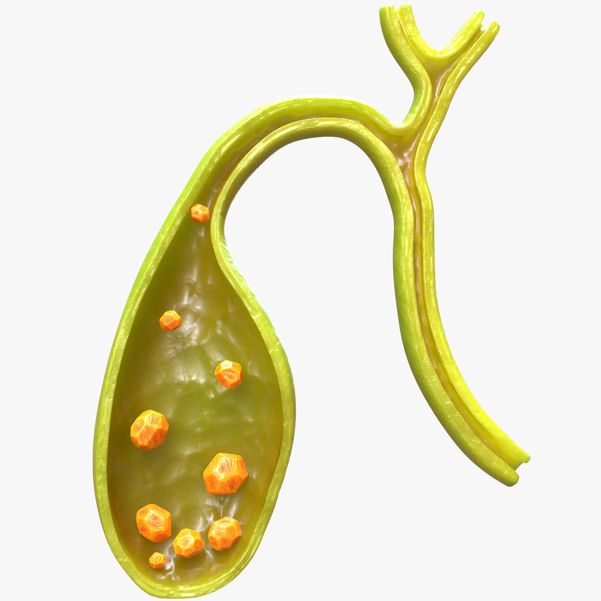 gallbladder-with-gallstones-3d-model