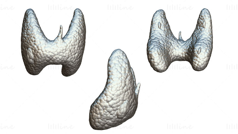 Modelo 3D de tiroides saludable y cáncer de tiroides