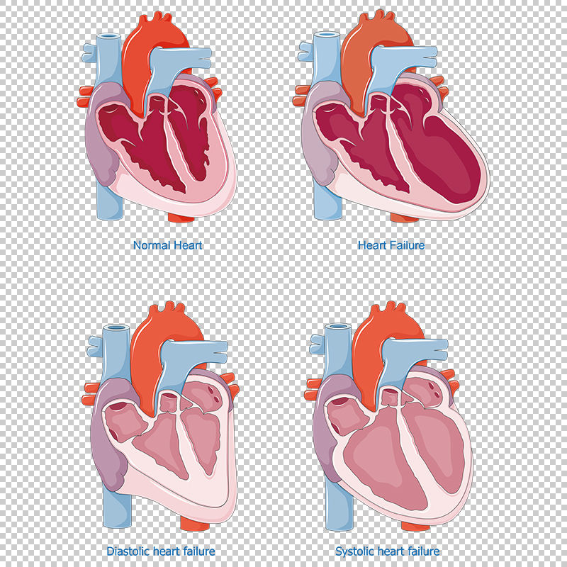 Heart Failure Vector heart-failure-vector