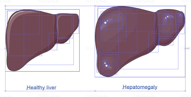 Vektor hepatomegalie