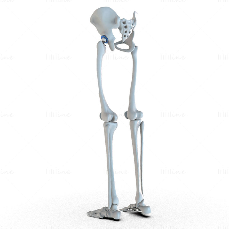 ایمپلنت تعویض مفصل ران در مدل سه بعدی استخوان لگن نصب شده است