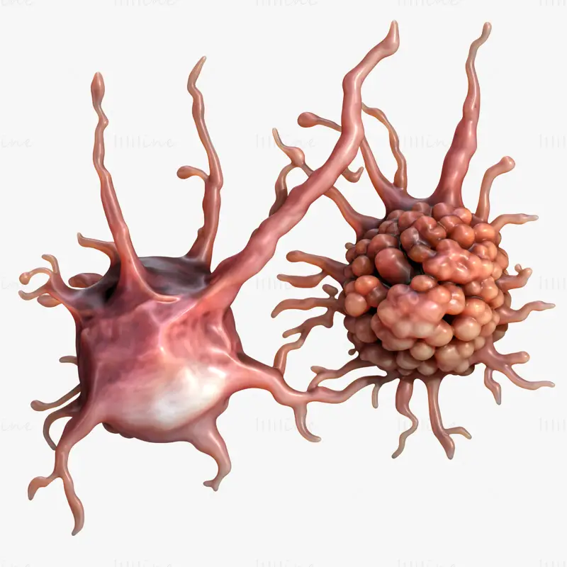 3D model lidského rakovinného nádoru