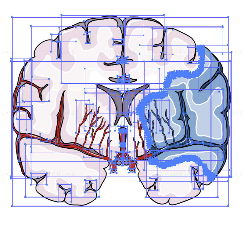 ilustração científica do vetor de acidente vascular cerebral isquêmico