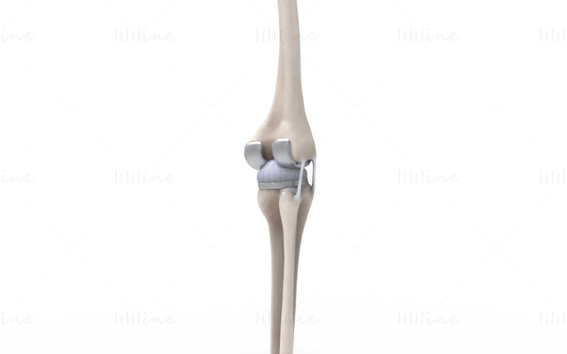 膝関節置換術の 3D シーン