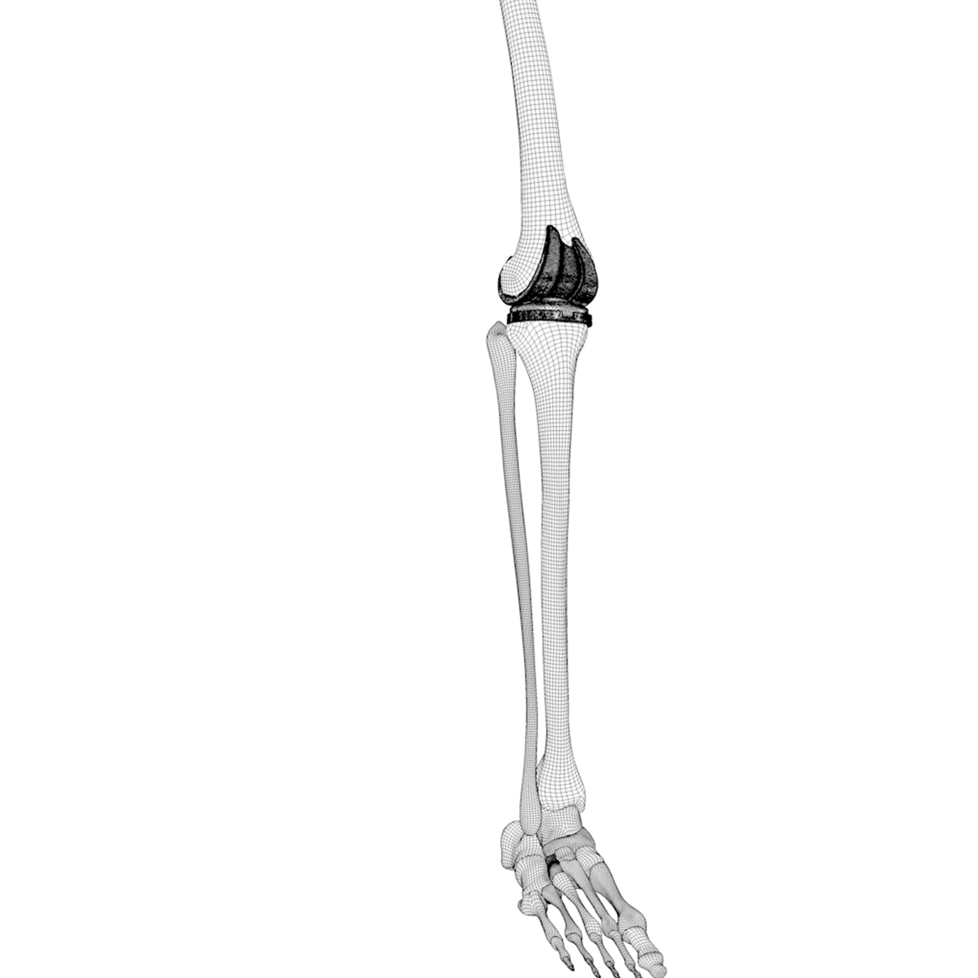 knee-replacement-implant-3d-model