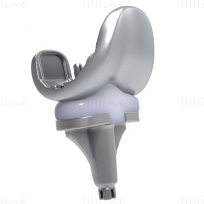 Knee Replacement Implant 3D Model C4D OBJ STL 3DS FBX