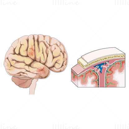 Meningitis vector scientific illustration