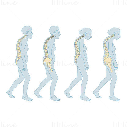 Vektorska znanstvena ilustracija osteoporoze v menopavzi