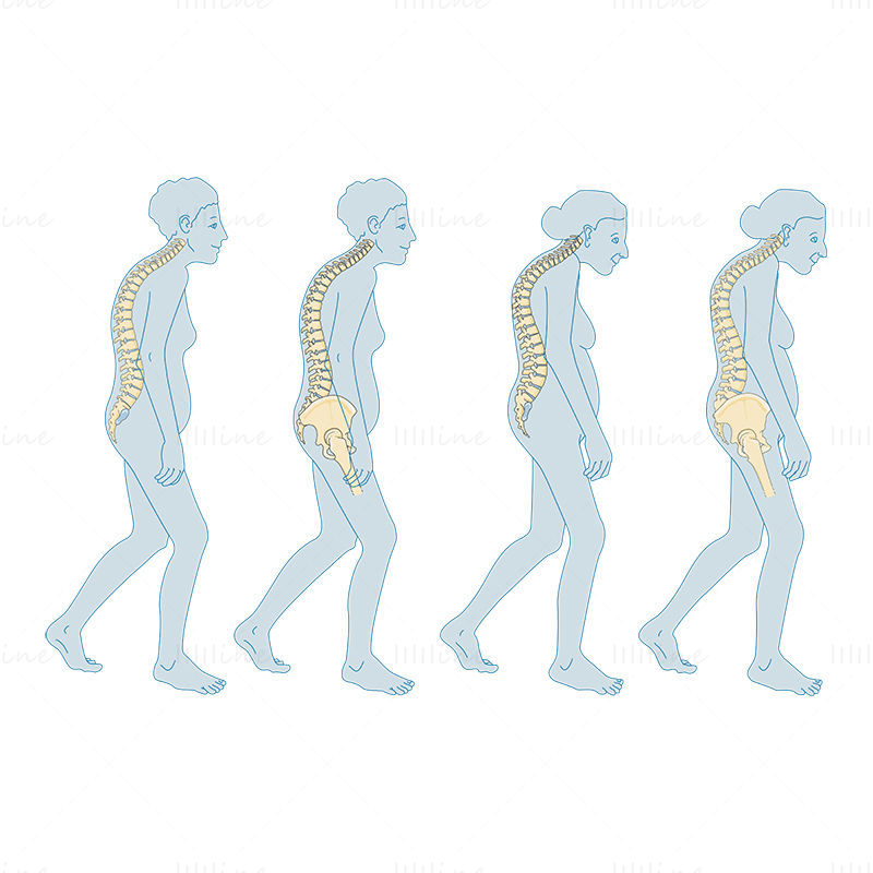 Menopause Osteoporosis vector scientific illustration