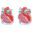 Mitral regurgitation vector