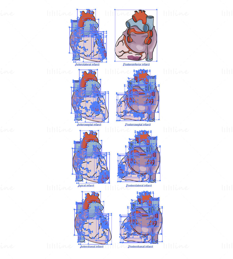 Myocardial infarctions vector