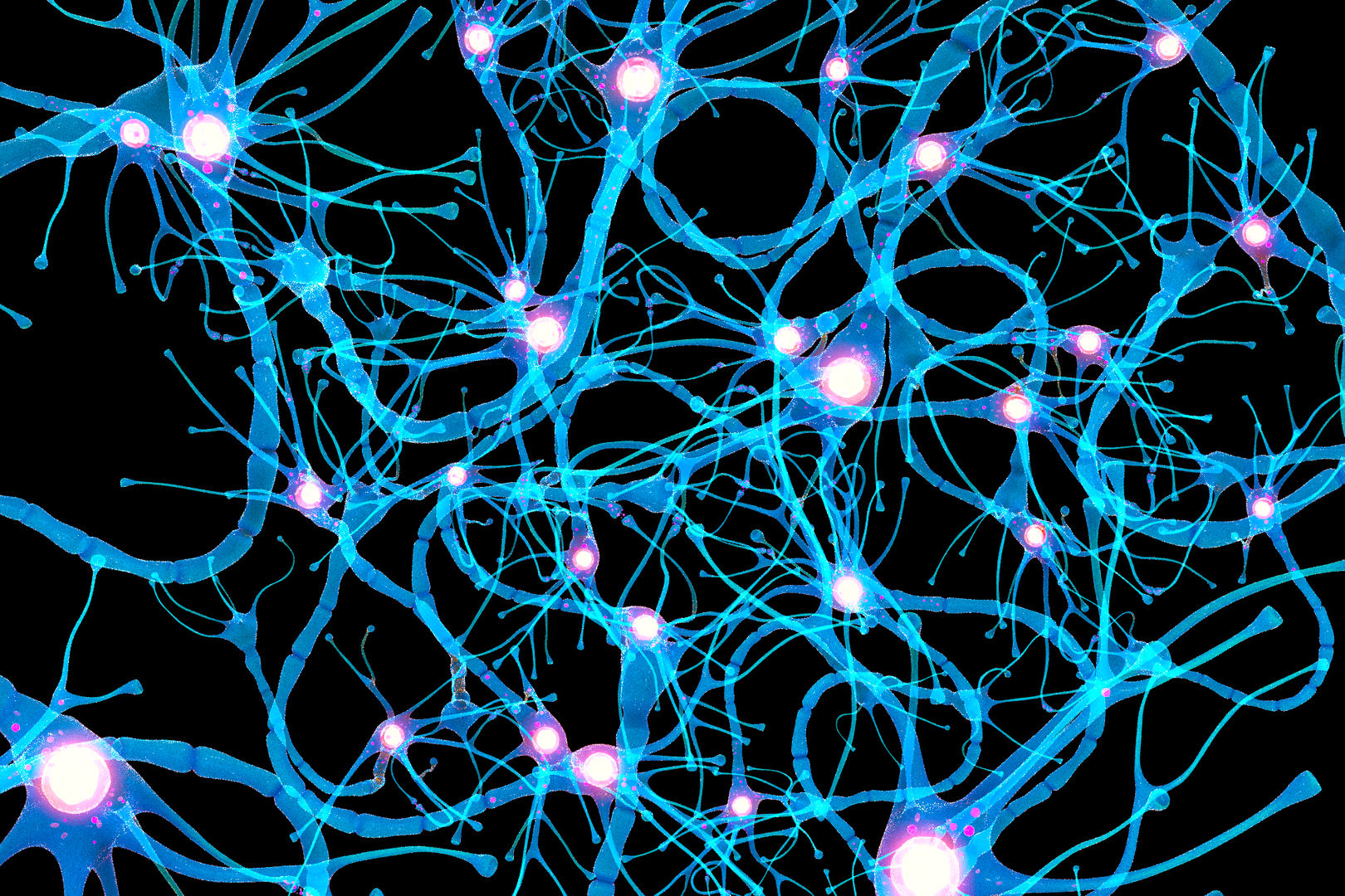 nerve-cell-anatomy-in-details-neuron-3d-model