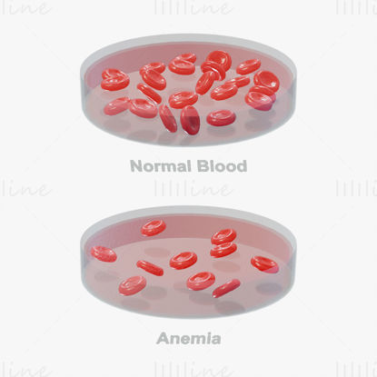 Normal Blood Cells vs Anemia 3D Model