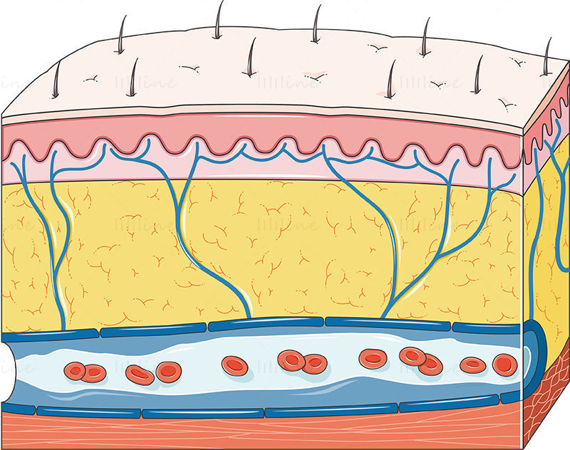 Vector de edema