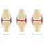 Osteoarthritis and rheumatoid arthritis vector scientific illustration