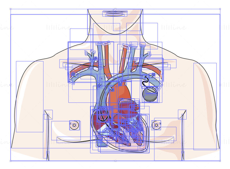 心脏起搏器矢量示意图