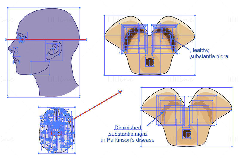 Parkinson hastalığı vektörü bilimsel çizimi