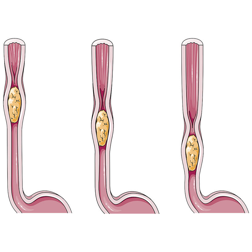 peristalsis-of-the-intestines-vector