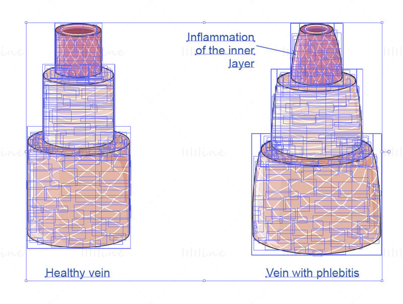 vector de flebitis