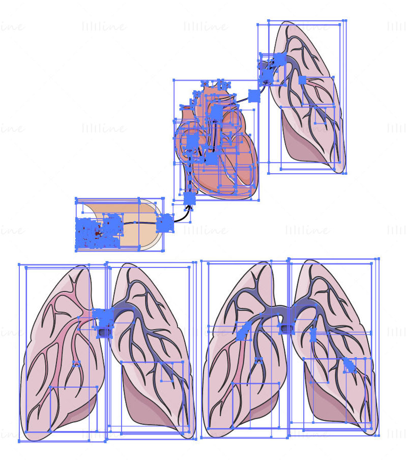 Pulmonary embolism vector
