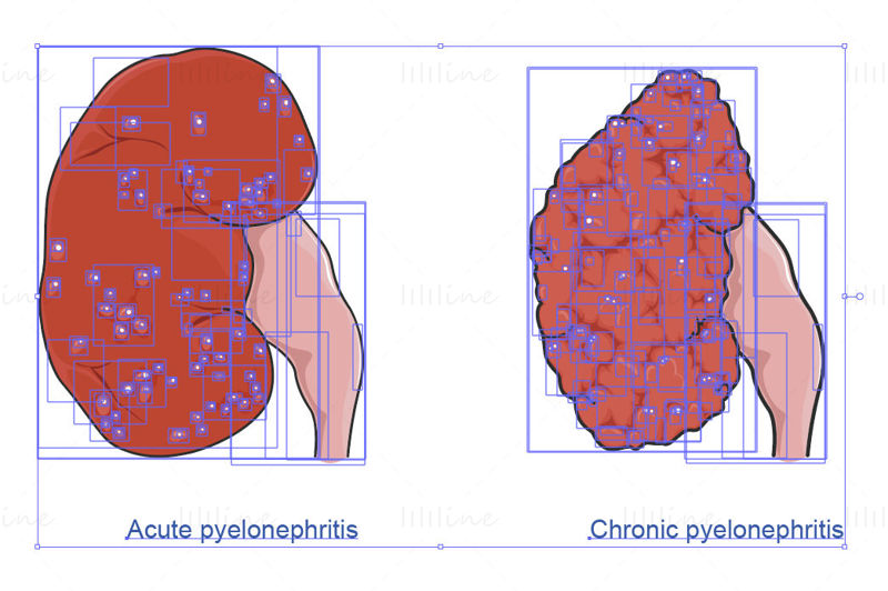 Pyelonephritis vector